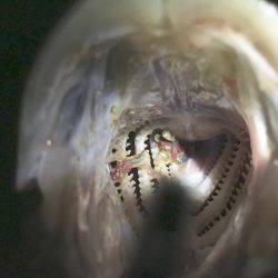 バチ抜け~!※グロ注意