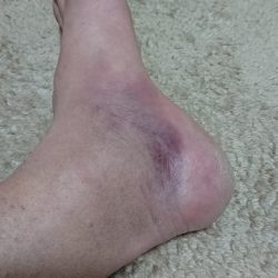 フィッシングボートACE(エース) 釣果