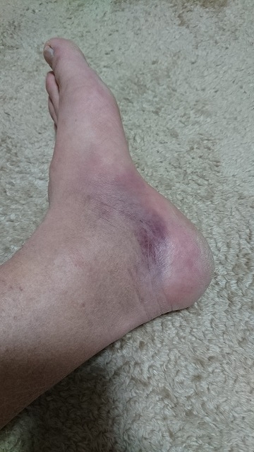 フィッシングボートACE(エース) 釣果