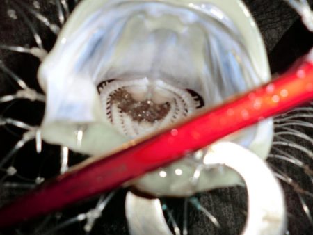 バチパターンでした。