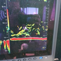 深川 吉野屋 釣果